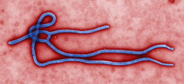 вирус эбола1